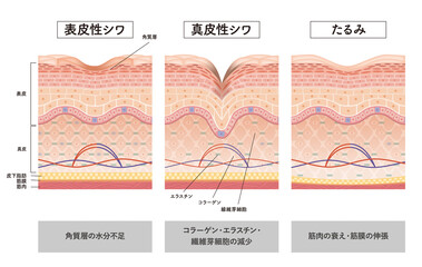 年齢肌に悩むあなたへ。しわの原因とコラーゲンの働きを理解し、K@Oで内側から若々しい素肌へ。|K@O